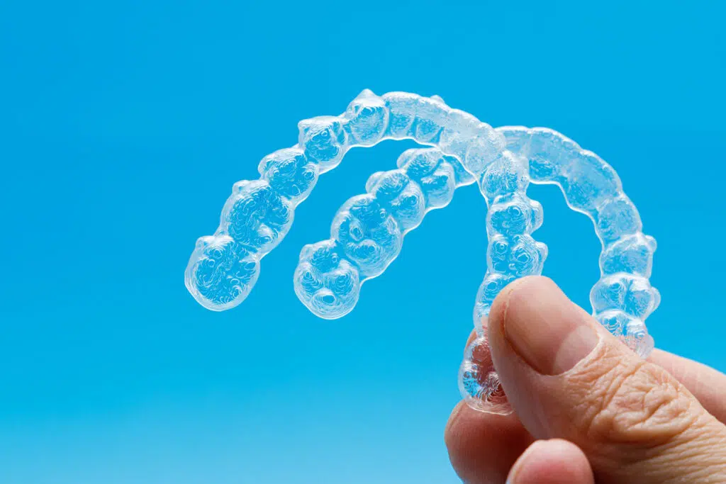 What factors affect the cost of clear aligners in Singapore?