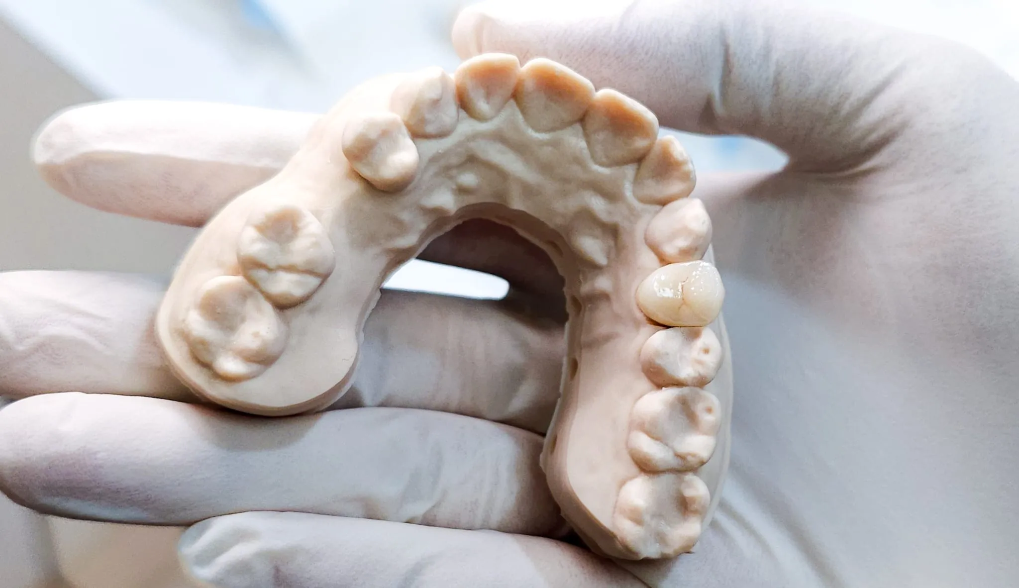 Same day crown on mold